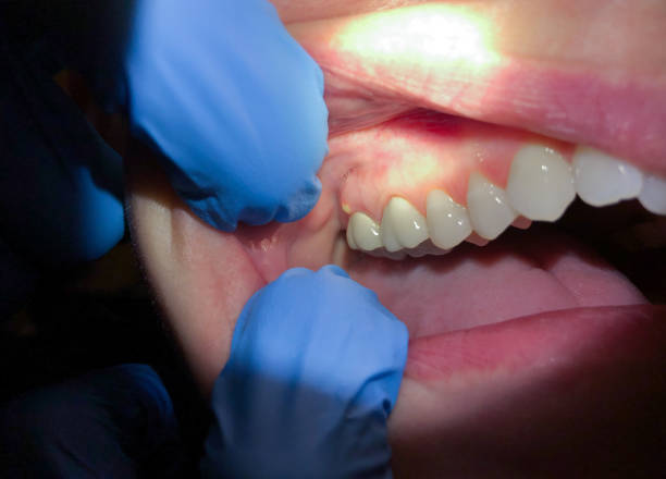 Best Emergency TMJ Treatment in Fords Prairie, WA