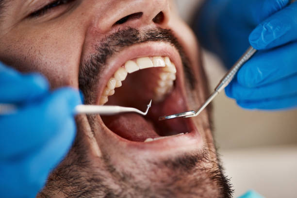 Best Emergency Denture Repair in Fords Prairie, WA